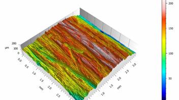 Bone surface analysis